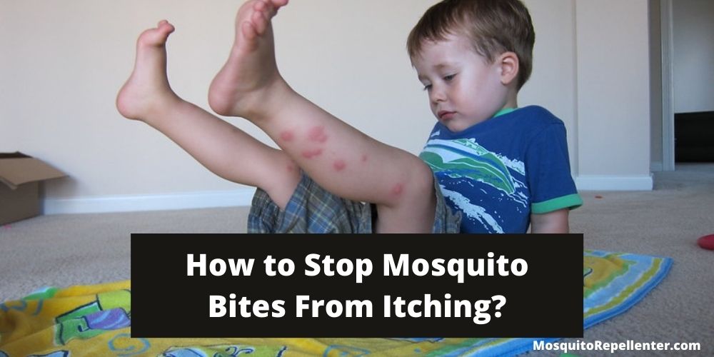 Mosquito bites Itching